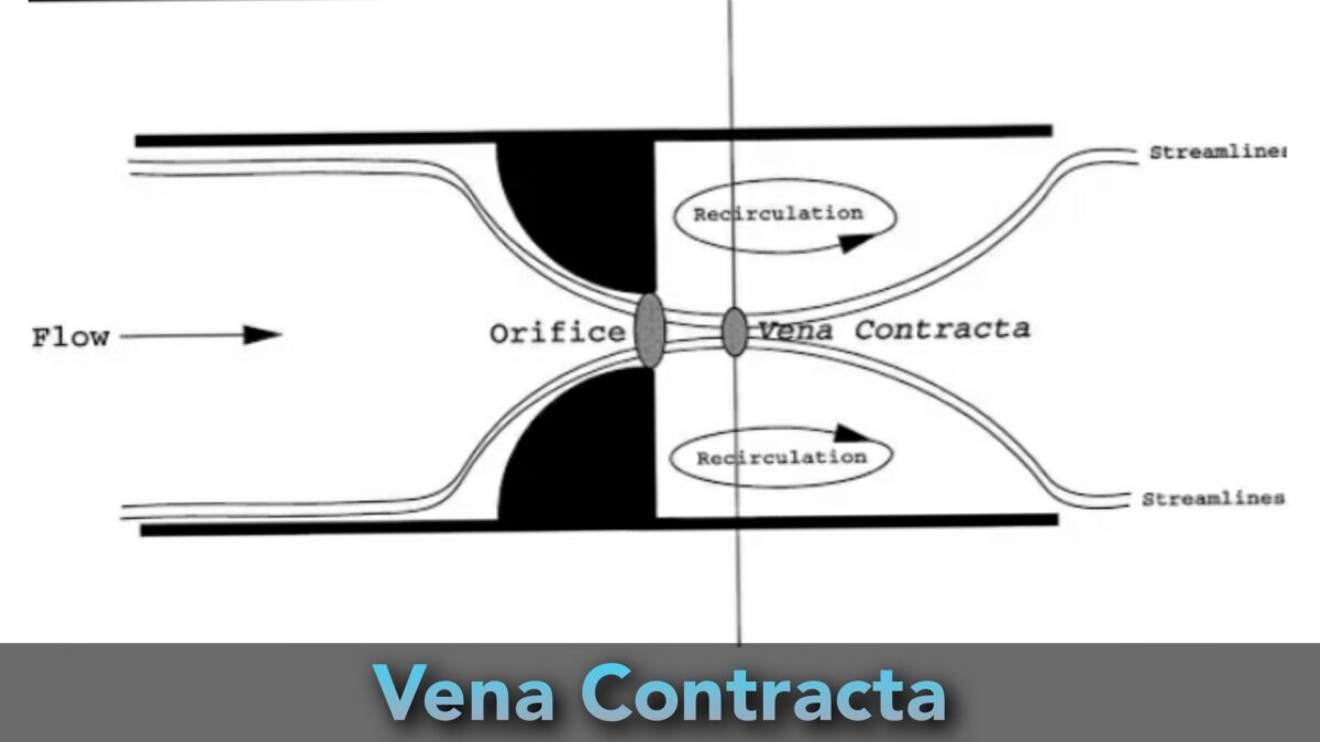 Vena Contracta